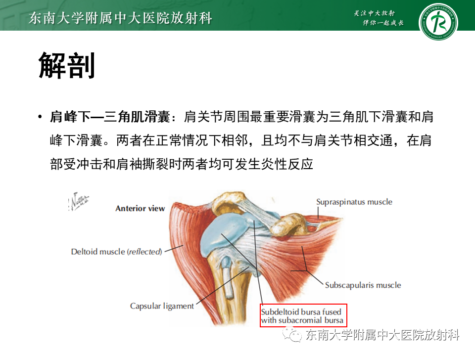 影像PPT - 【PPT】肩峰下撞击综合征-10 影像PPT - 【PPT】肩峰下撞击综合征-10