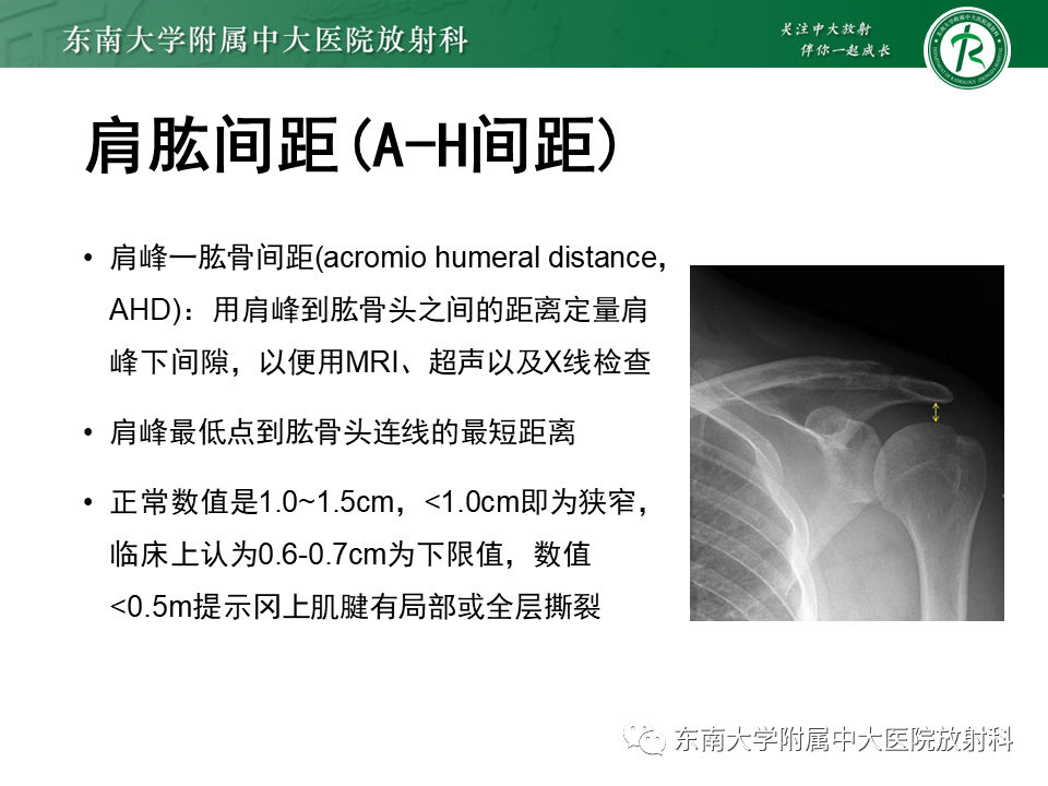 影像PPT - 【PPT】肩峰下撞击综合征-13 影像PPT - 【PPT】肩峰下撞击综合征-13