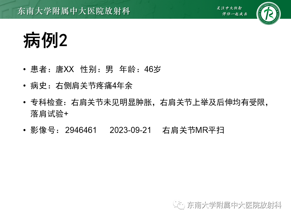 影像PPT - 【PPT】肩峰下撞击综合征-15 影像PPT - 【PPT】肩峰下撞击综合征-15