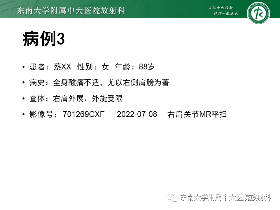 影像PPT - 【PPT】肩峰下撞击综合征-18 影像PPT - 【PPT】肩峰下撞击综合征-18