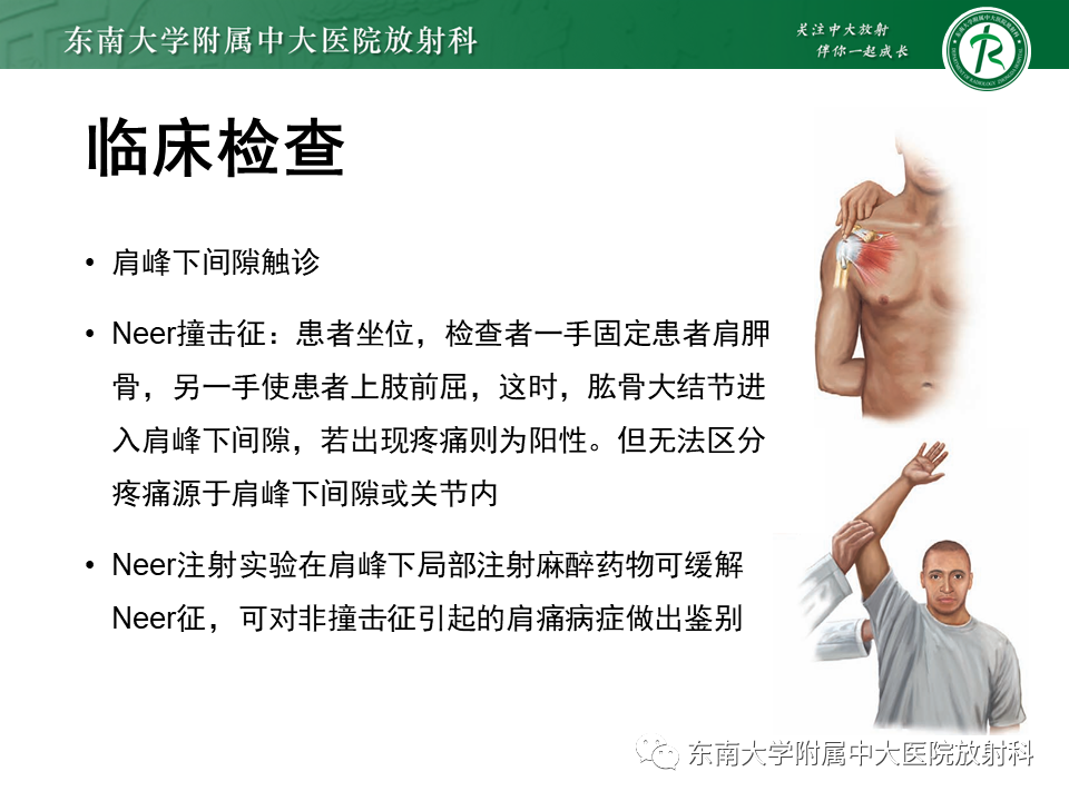 影像PPT - 【PPT】肩峰下撞击综合征-21 影像PPT - 【PPT】肩峰下撞击综合征-21