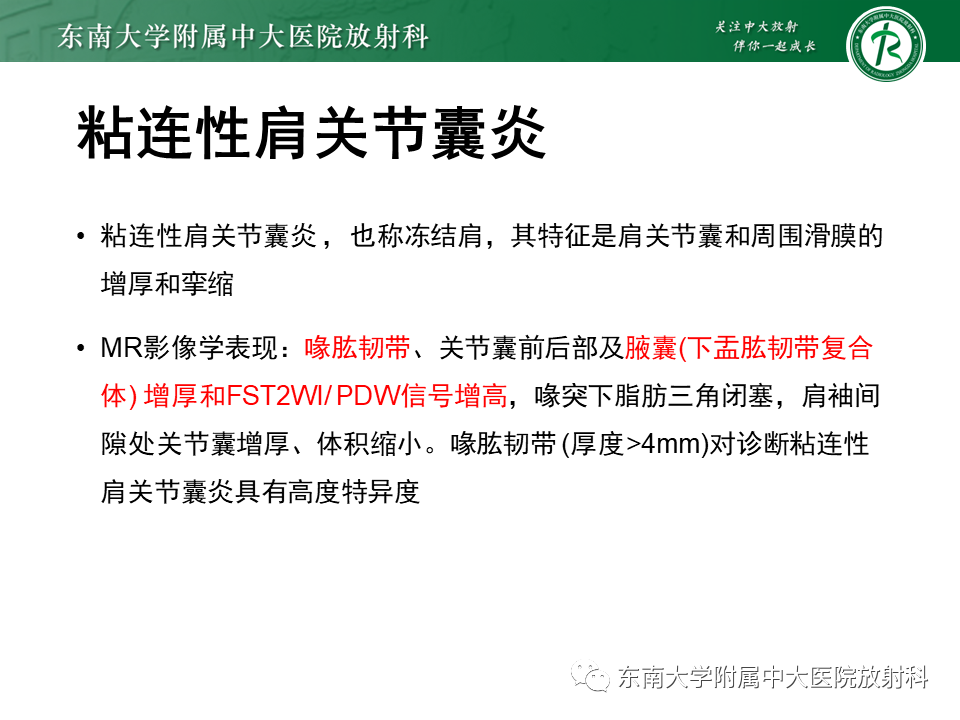 影像PPT - 【PPT】肩峰下撞击综合征-29 影像PPT - 【PPT】肩峰下撞击综合征-29