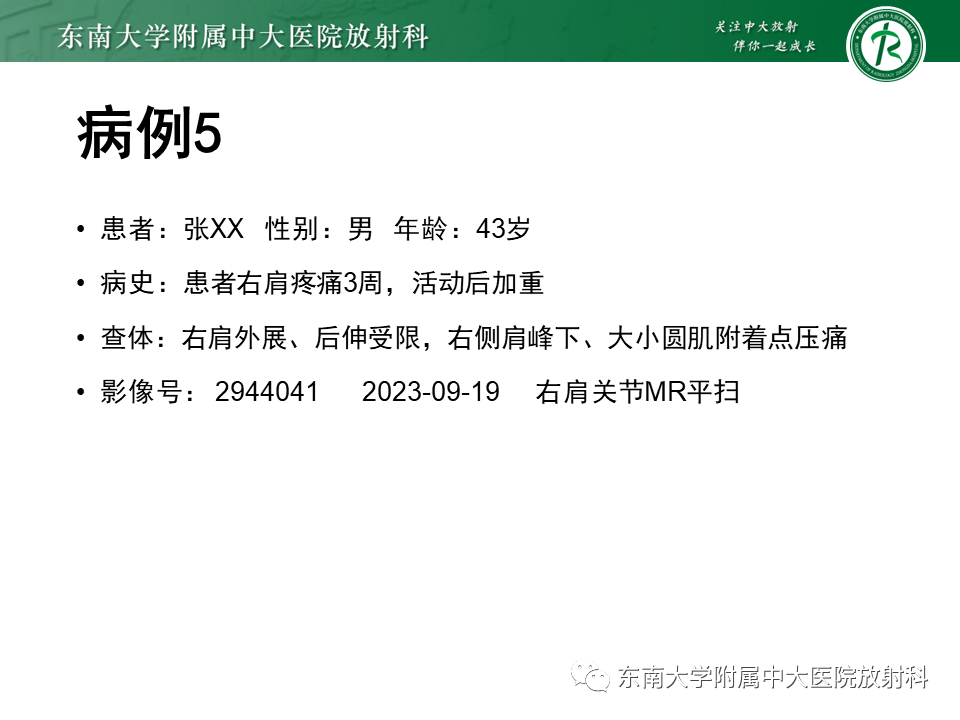 影像PPT - 【PPT】肩峰下撞击综合征-30 影像PPT - 【PPT】肩峰下撞击综合征-30