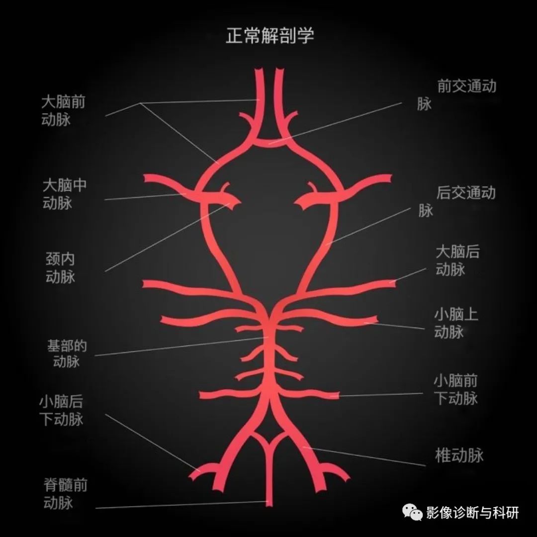 影像PPT - 小脑供血动脉及供应范围、不同分支梗塞表现-1 影像PPT - 小脑供血动脉及供应范围、不同分支梗塞表现-1