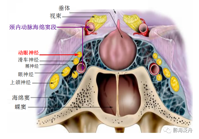 影像PPT - 【病例】痛性眼肌麻痹综合征1例MR影像-12 影像PPT - 【病例】痛性眼肌麻痹综合征1例MR影像-12