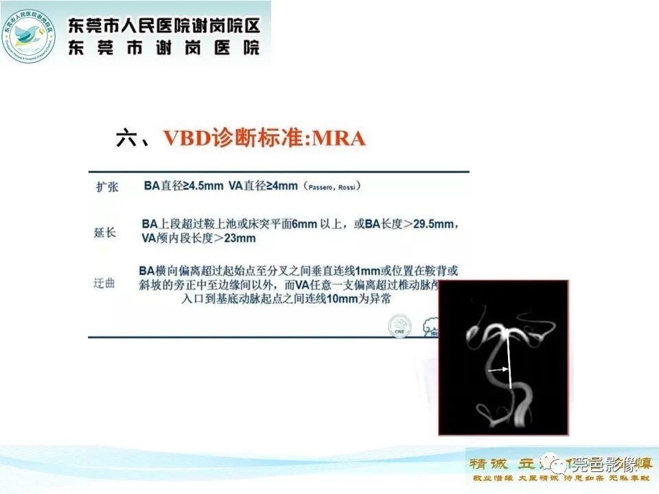 影像PPT - 【PPT】椎基底动脉延长扩张症-13
