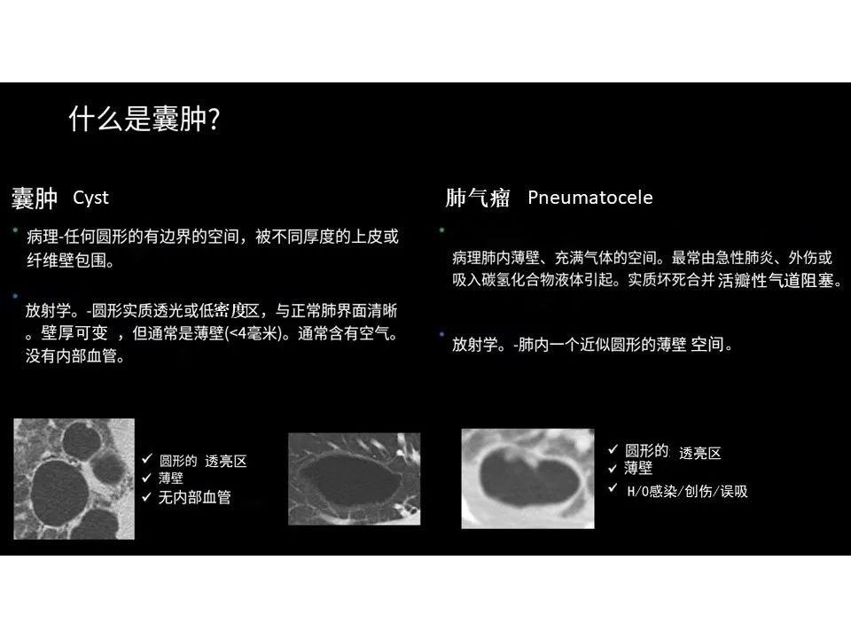 影像PPT - 【PPT】囊性肺疾病的影像学-病理相关性-3
