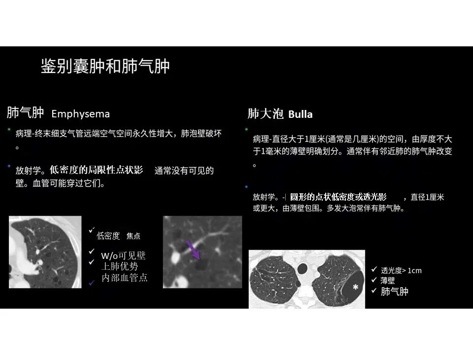 影像PPT - 【PPT】囊性肺疾病的影像学-病理相关性-4