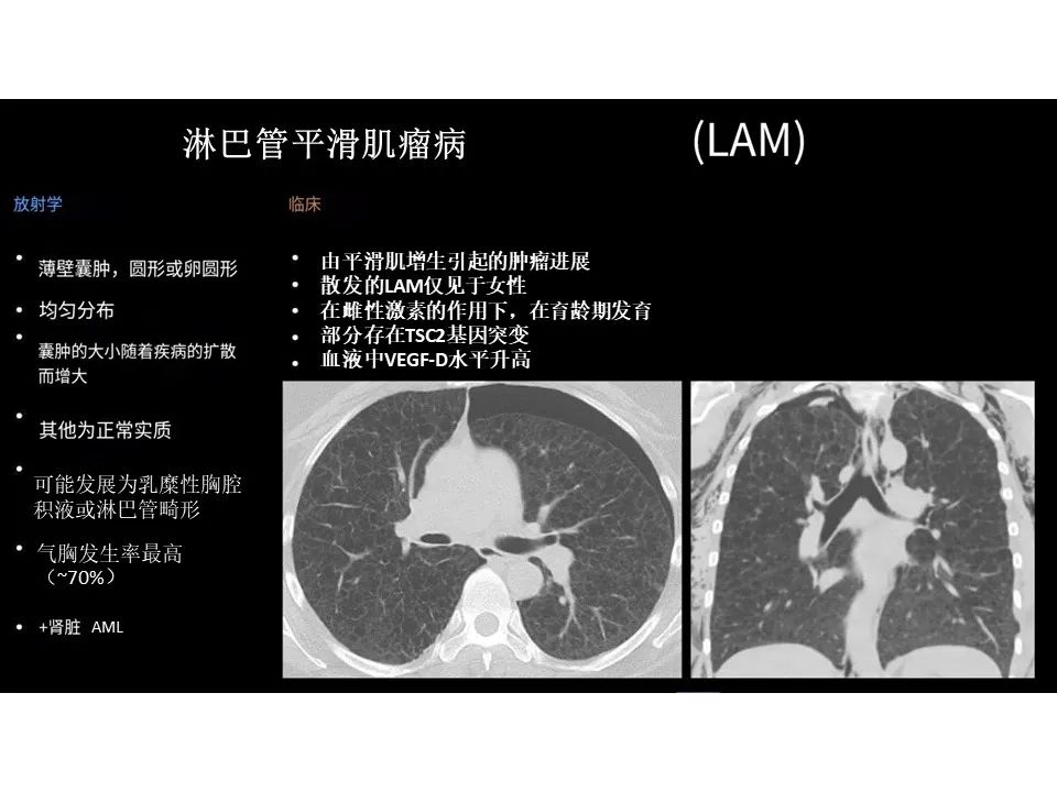 影像PPT - 【PPT】囊性肺疾病的影像学-病理相关性-5