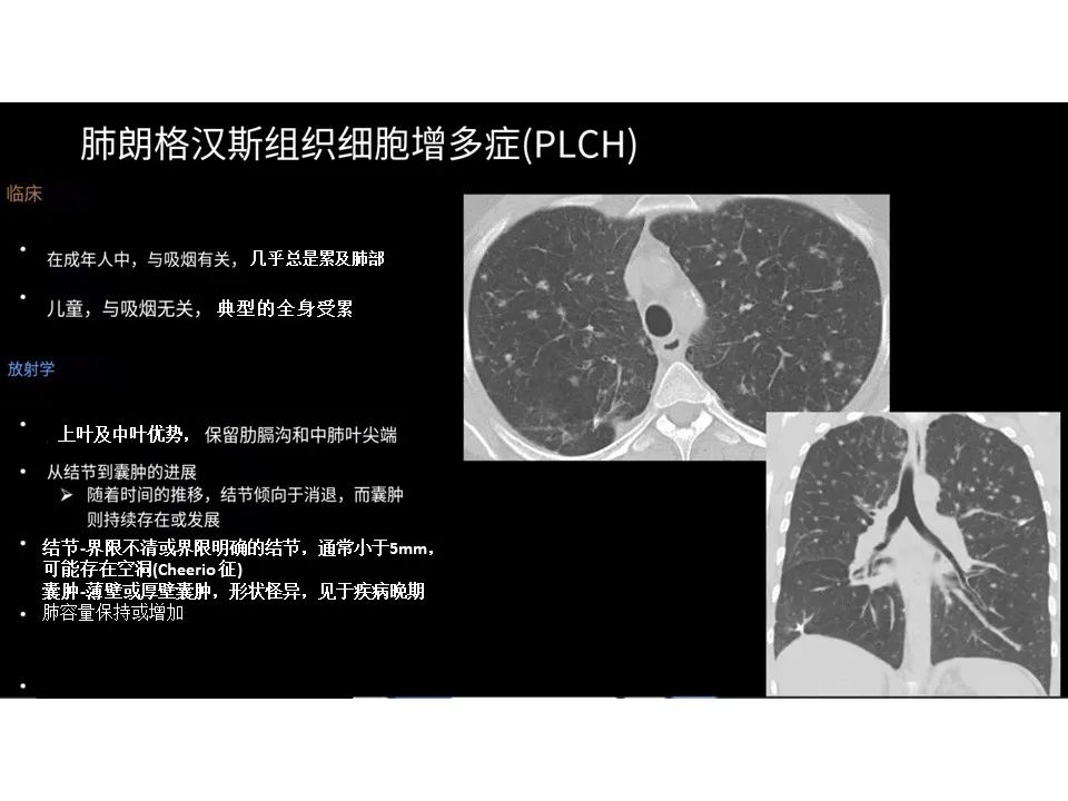 影像PPT - 【PPT】囊性肺疾病的影像学-病理相关性-9