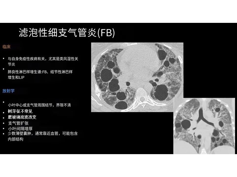 影像PPT - 【PPT】囊性肺疾病的影像学-病理相关性-16