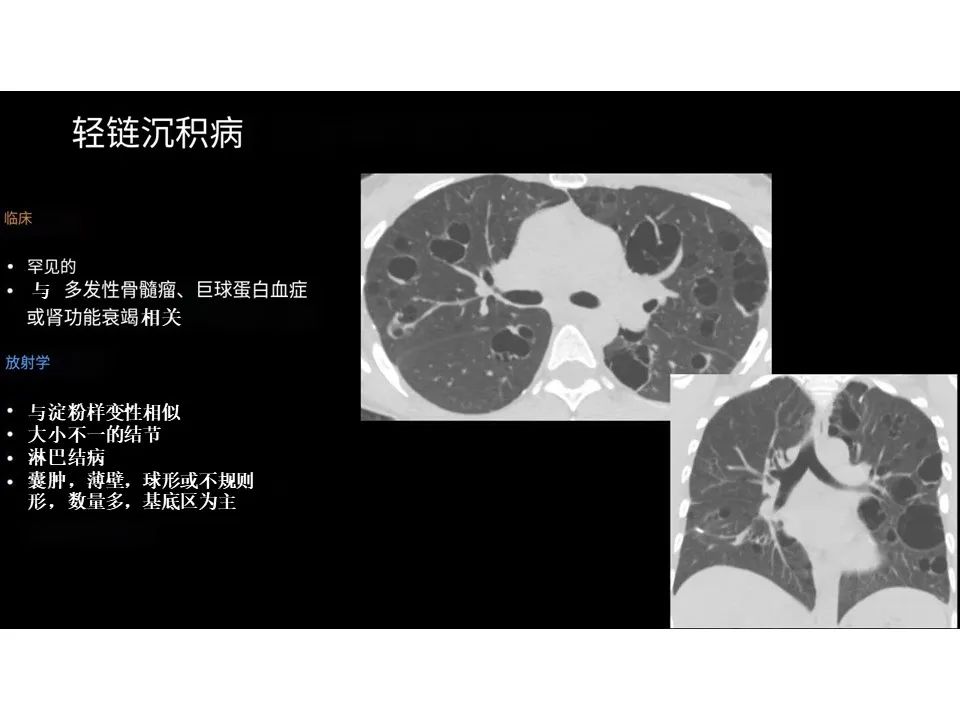 影像PPT - 【PPT】囊性肺疾病的影像学-病理相关性-20