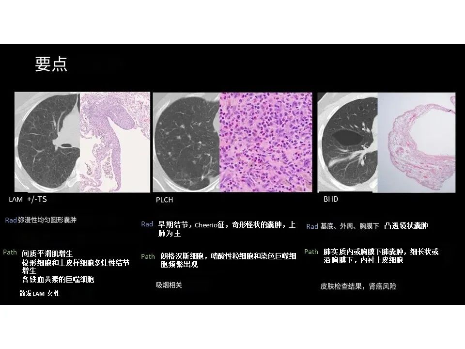 影像PPT - 【PPT】囊性肺疾病的影像学-病理相关性-32