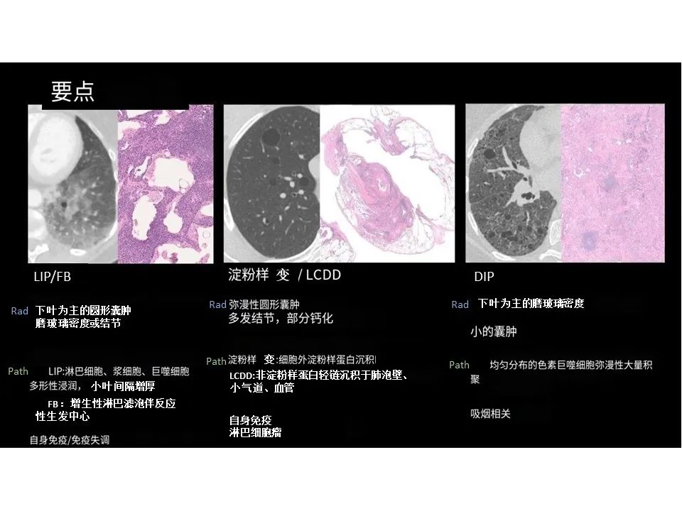 影像PPT - 【PPT】囊性肺疾病的影像学-病理相关性-33