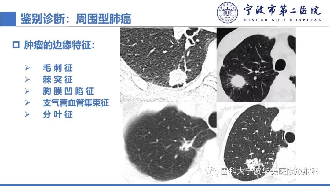 影像PPT - 【PPT】肉芽肿性肺疾病-16