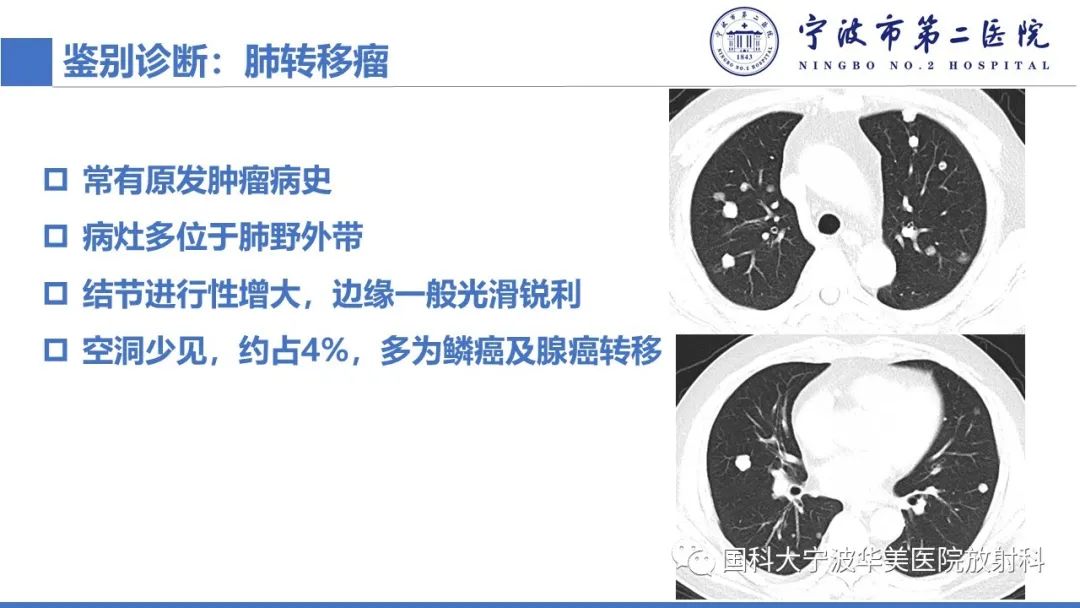 影像PPT - 【PPT】肉芽肿性肺疾病-18