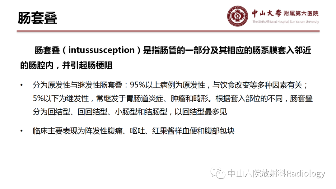 影像PPT - 【PPT】肠梗阻影像学表现与常见病因-29