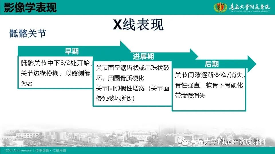 影像PPT - 【PPT】强直性脊柱炎-13