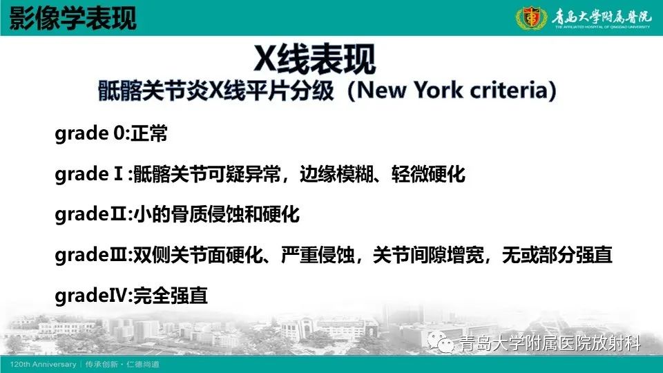 影像PPT - 【PPT】强直性脊柱炎-14