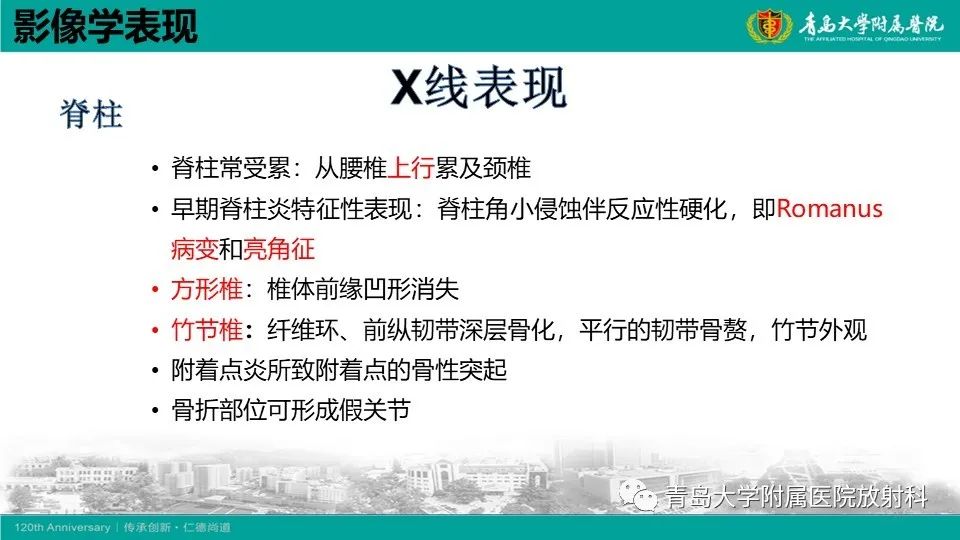 影像PPT - 【PPT】强直性脊柱炎-16
