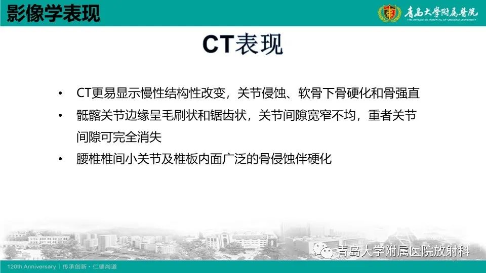 影像PPT - 【PPT】强直性脊柱炎-18