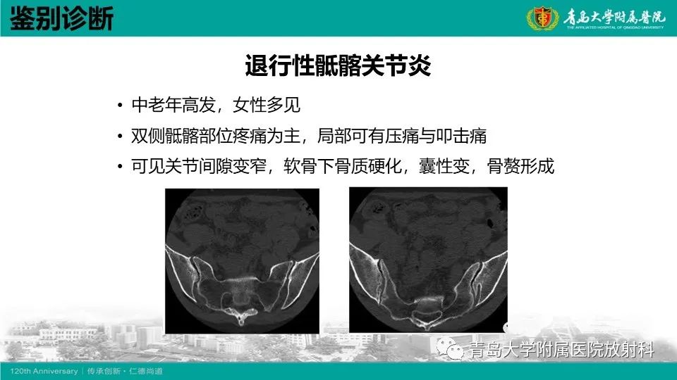 影像PPT - 【PPT】强直性脊柱炎-23
