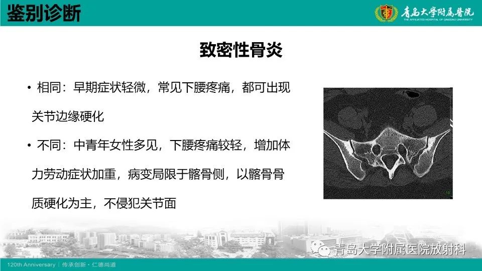 影像PPT - 【PPT】强直性脊柱炎-24