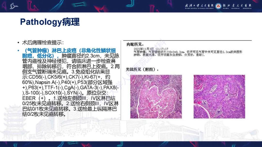 影像PPT - 【PPT】气管支气管肿瘤影像诊断-5