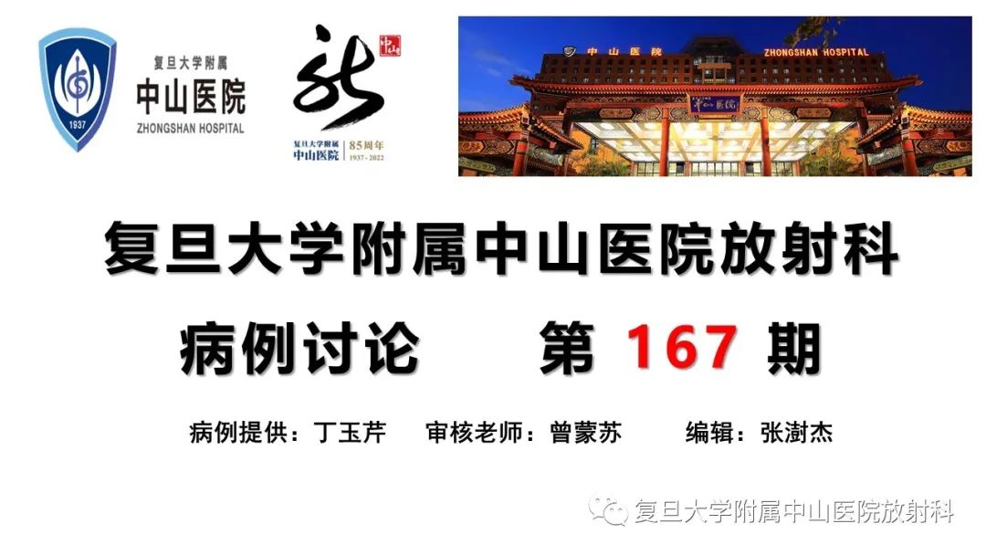 影像PPT - 【病例】肾上腺嗜铬细胞瘤伴转移1例CT及MR影像-1
