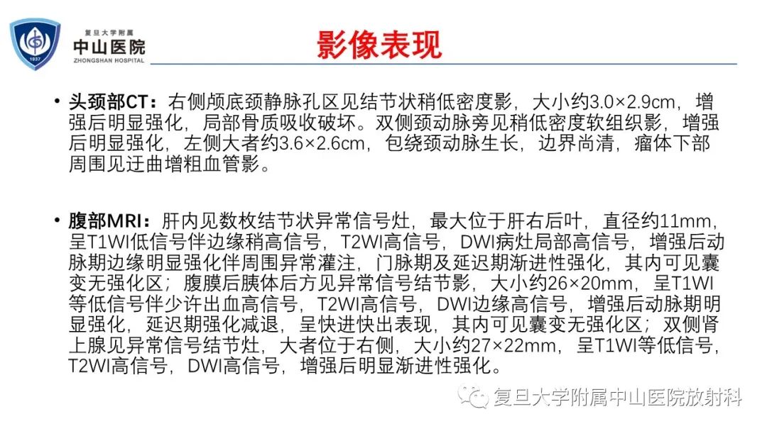 影像PPT - 【病例】肾上腺嗜铬细胞瘤伴转移1例CT及MR影像-11