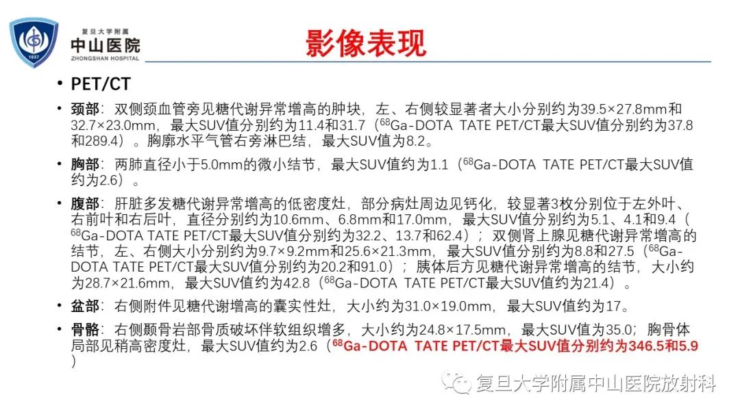 影像PPT - 【病例】肾上腺嗜铬细胞瘤伴转移1例CT及MR影像-12