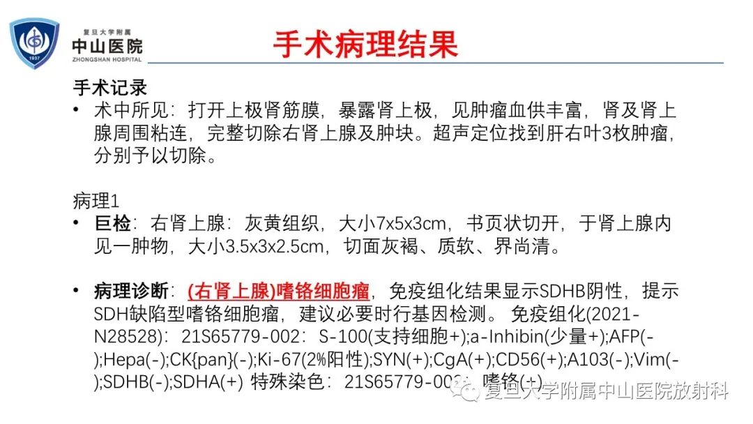 影像PPT - 【病例】肾上腺嗜铬细胞瘤伴转移1例CT及MR影像-13