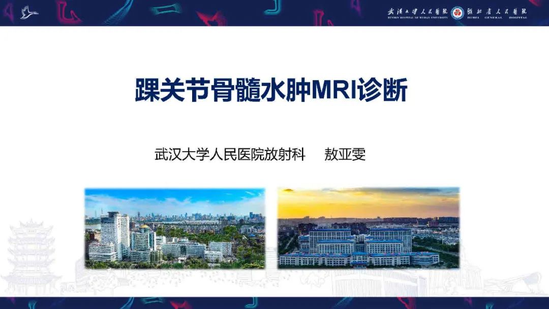 影像PPT - 【PPT】踝关节骨髓水肿MRI诊断-1