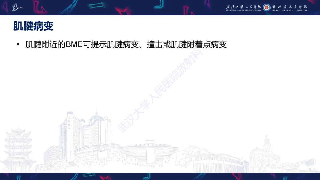 影像PPT - 【PPT】踝关节骨髓水肿MRI诊断-11