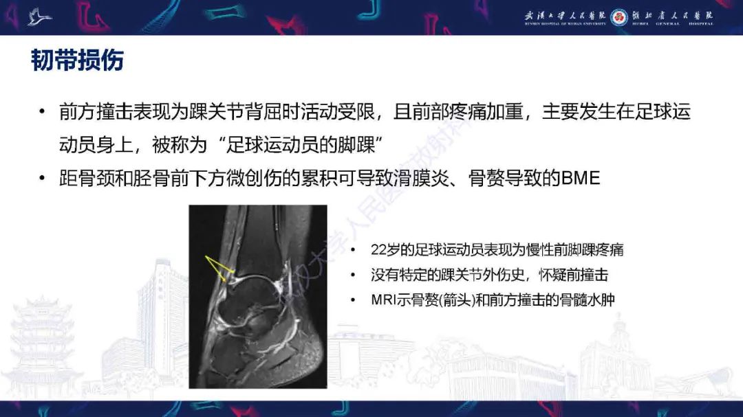 影像PPT - 【PPT】踝关节骨髓水肿MRI诊断-25