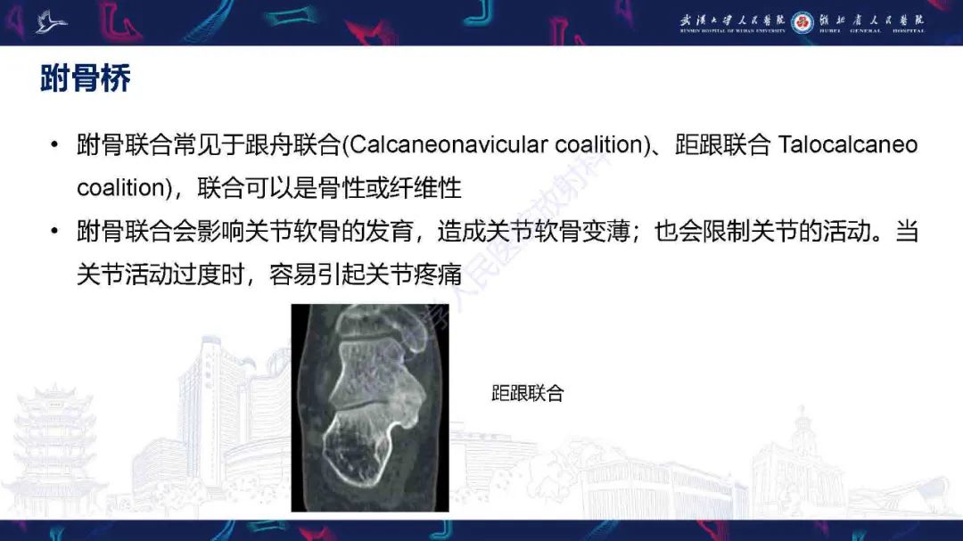 影像PPT - 【PPT】踝关节骨髓水肿MRI诊断-27