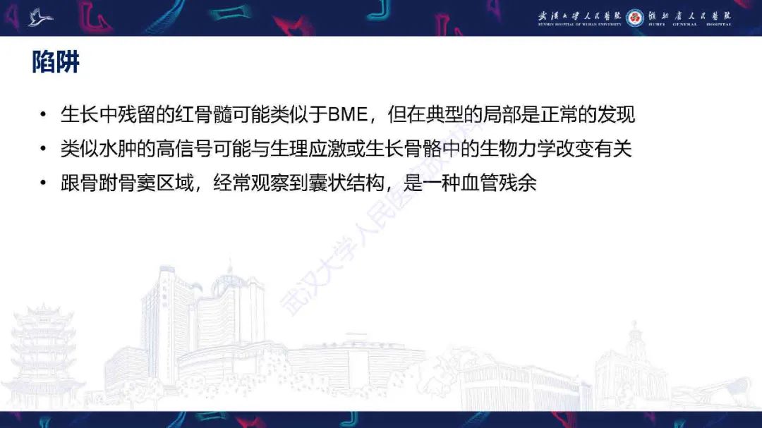 影像PPT - 【PPT】踝关节骨髓水肿MRI诊断-34