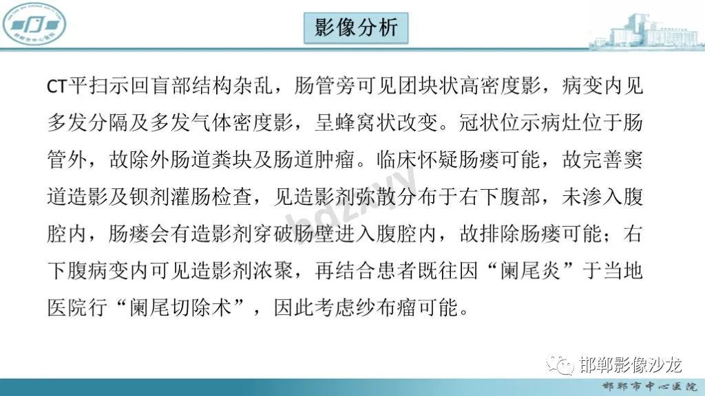 影像PPT - 腹腔内的“蜂窝征”-3 影像PPT - 腹腔内的“蜂窝征”-3