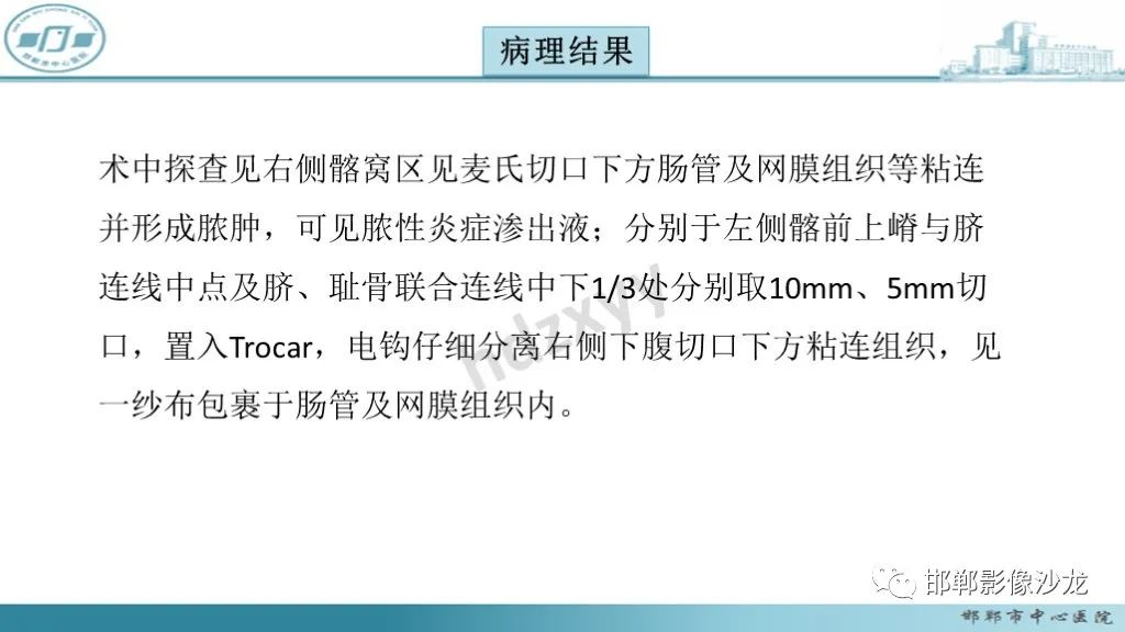 影像PPT - 腹腔内的“蜂窝征”-6 影像PPT - 腹腔内的“蜂窝征”-6