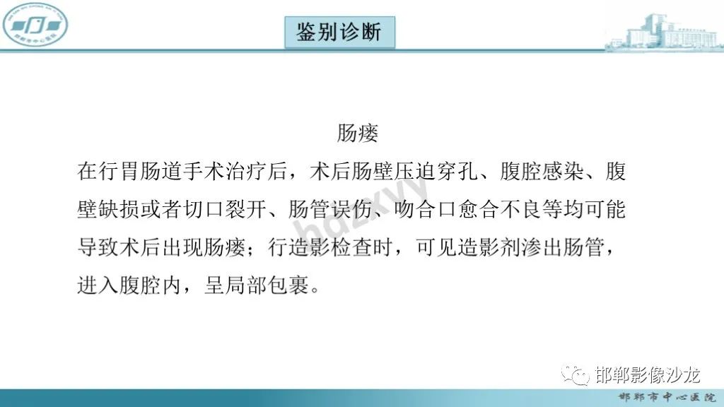 影像PPT - 腹腔内的“蜂窝征”-18 影像PPT - 腹腔内的“蜂窝征”-18