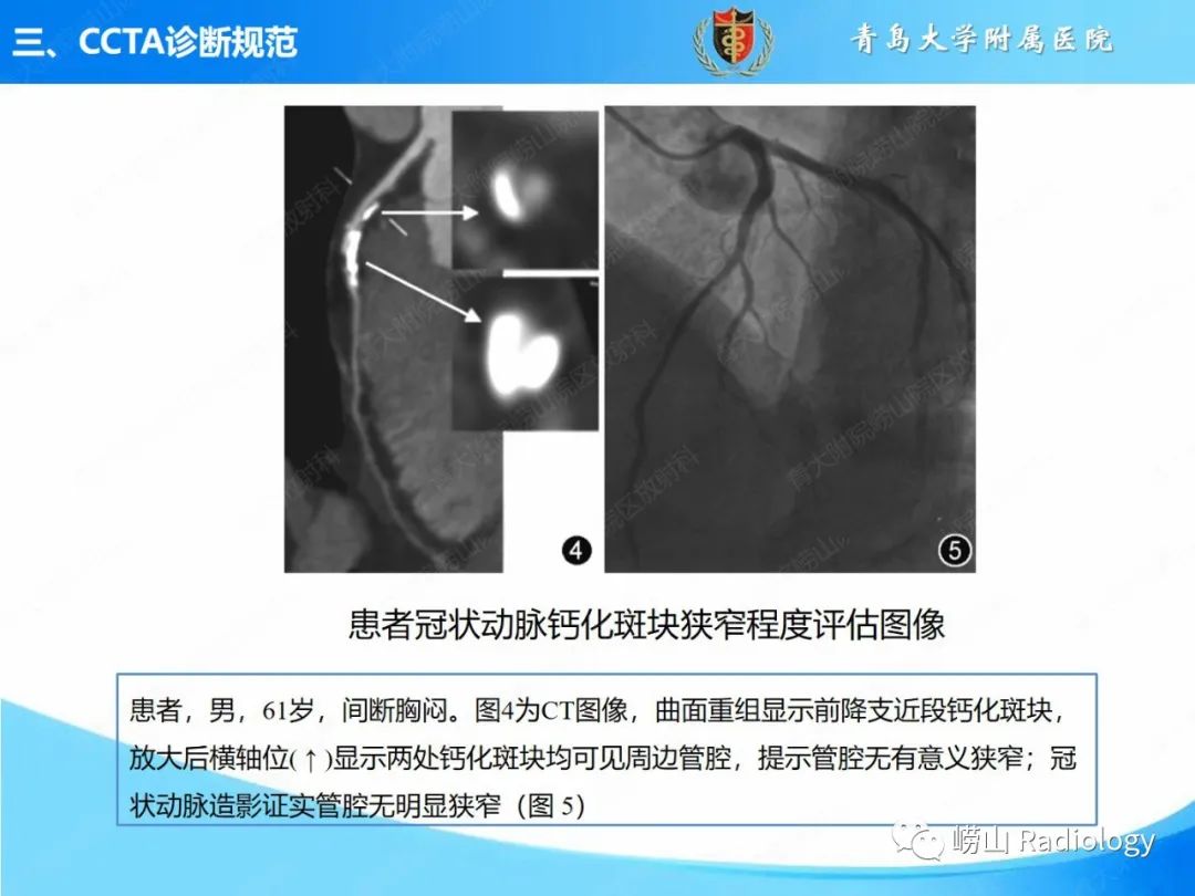 影像PPT - 【PPT】冠状动脉CT血管成像最新临床应用推荐及诊断规范-21