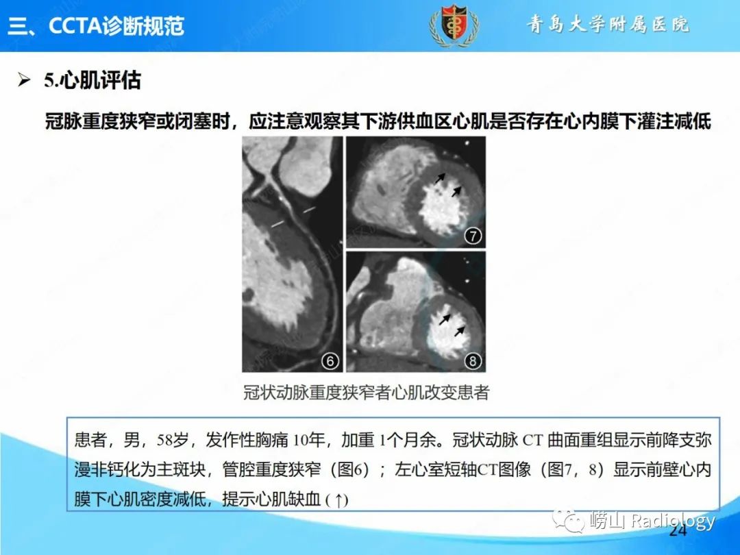 影像PPT - 【PPT】冠状动脉CT血管成像最新临床应用推荐及诊断规范-23