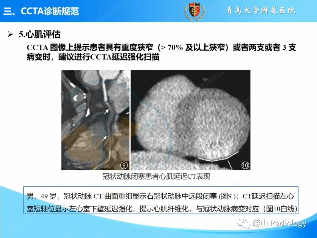 影像PPT - 【PPT】冠状动脉CT血管成像最新临床应用推荐及诊断规范-24