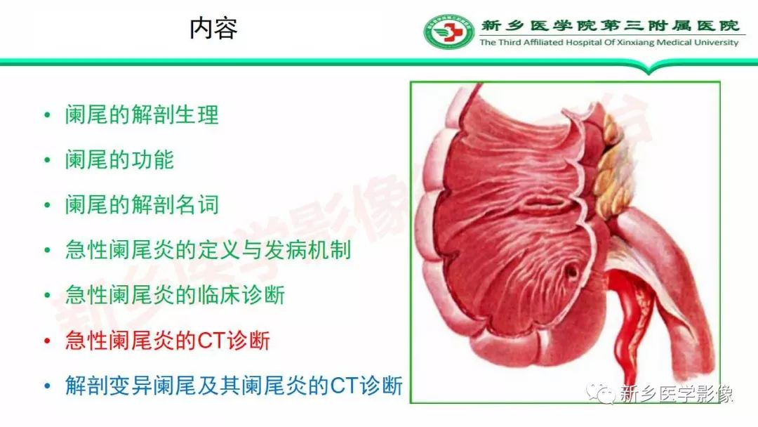影像PPT - 【PPT】急性阑尾炎的CT诊断-2