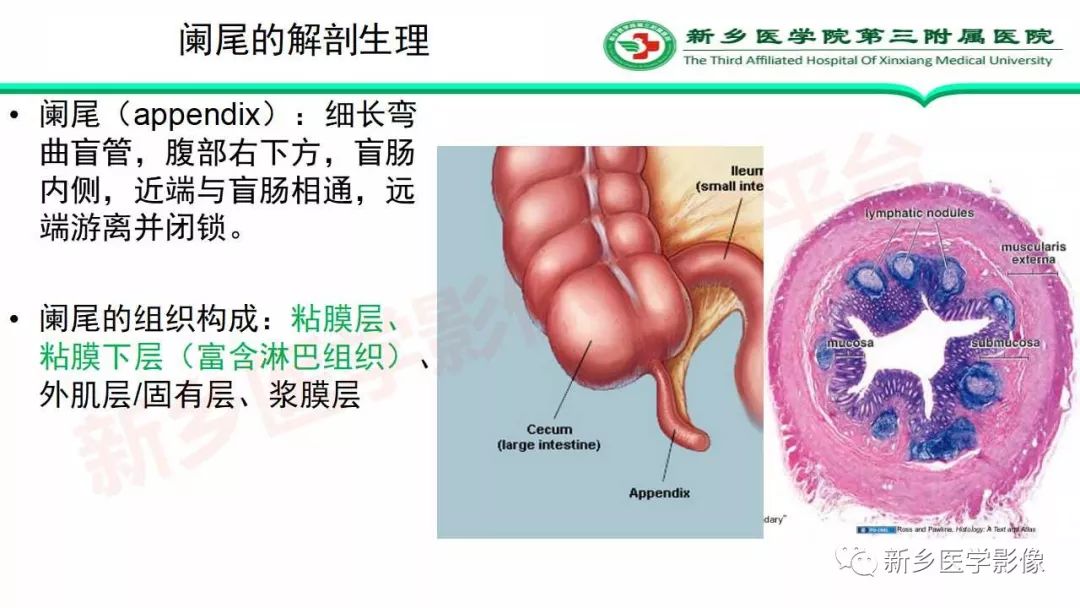 影像PPT - 【PPT】急性阑尾炎的CT诊断-3