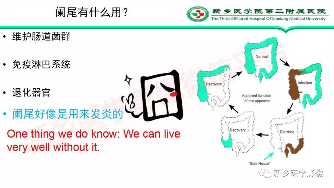 影像PPT - 【PPT】急性阑尾炎的CT诊断-4