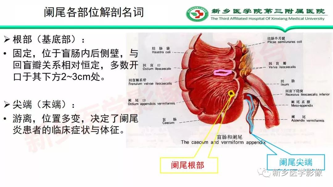 影像PPT - 【PPT】急性阑尾炎的CT诊断-5