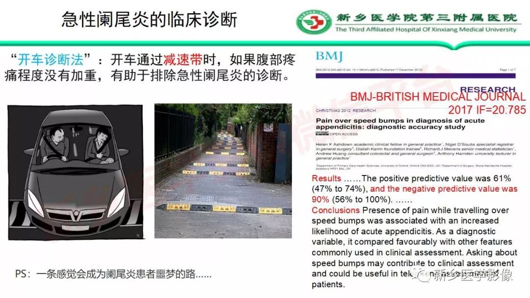 影像PPT - 【PPT】急性阑尾炎的CT诊断-10