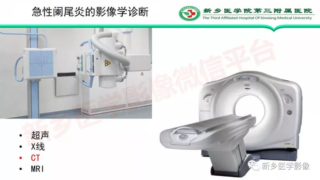 影像PPT - 【PPT】急性阑尾炎的CT诊断-11