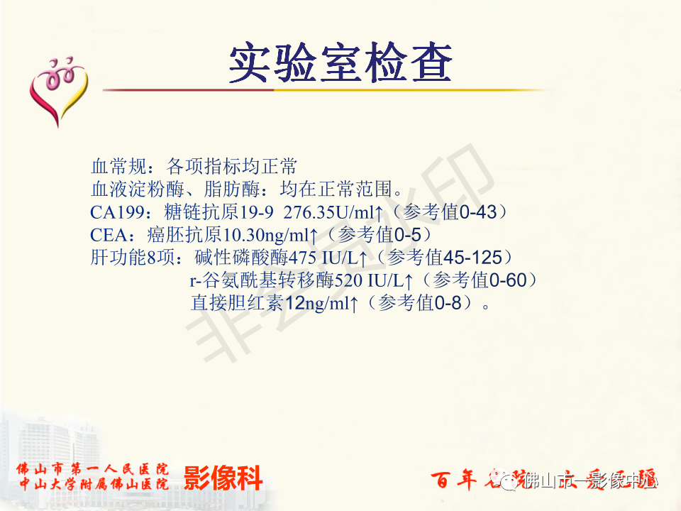影像PPT - 【病例】胰腺淋巴瘤1例CT及MR影像-3
